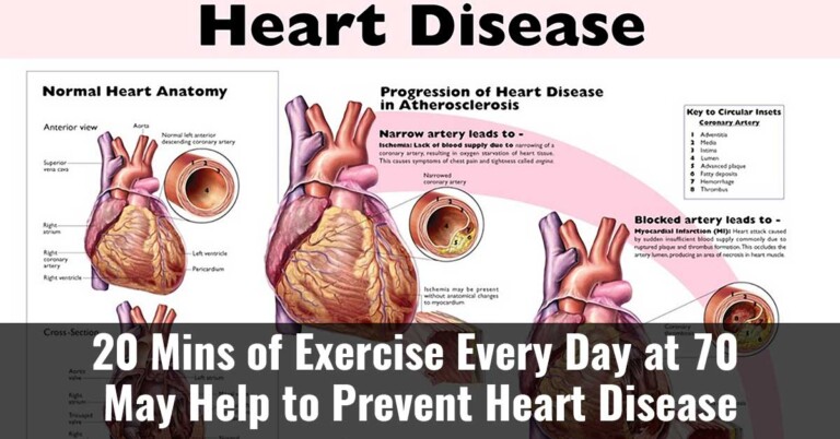 20 Mins Of Exercise Every Day At 70 May Help To Prevent Heart Disease