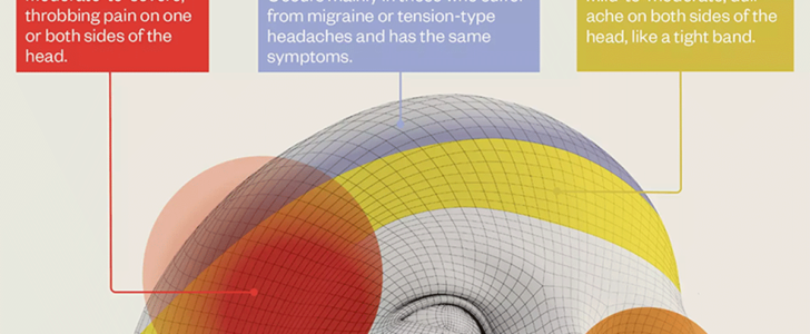 A Visual Guide To Headaches Infographic F