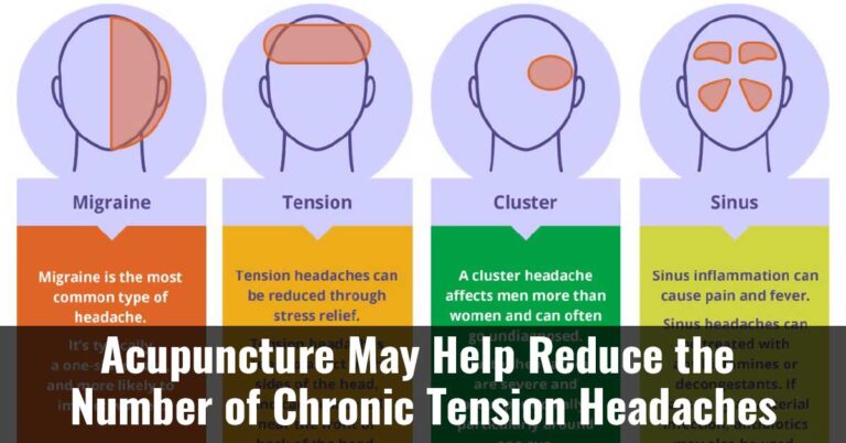 Acupuncture May Help Reduce The Number Of Chronic Tension Headaches