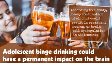 Adolescent Binge Drinking Could Have A Permanent Impact On The Brain F