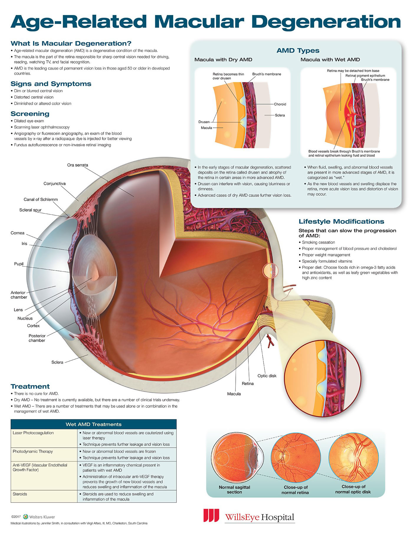 Age Related Macular Degeneration Anatomical Chart