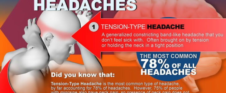 All About Headaches Infographic F