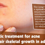 Antibiotic Treatment For Acne Can Impair Skeletal Growth In Adolescents F