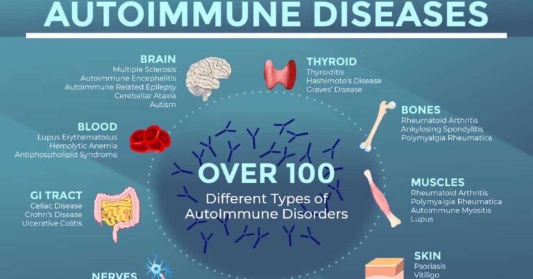 Autoimmune Disease Infographic F