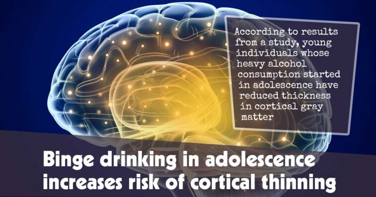 Binge Drinking In Adolescence Increases Risk Of Cortical Thinning F