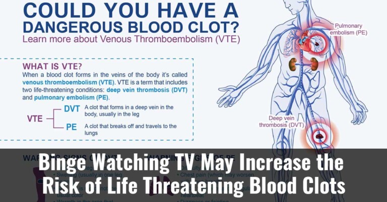 Binge Watching Tv May Increase The Risk Of Life Threatening Blood Clots