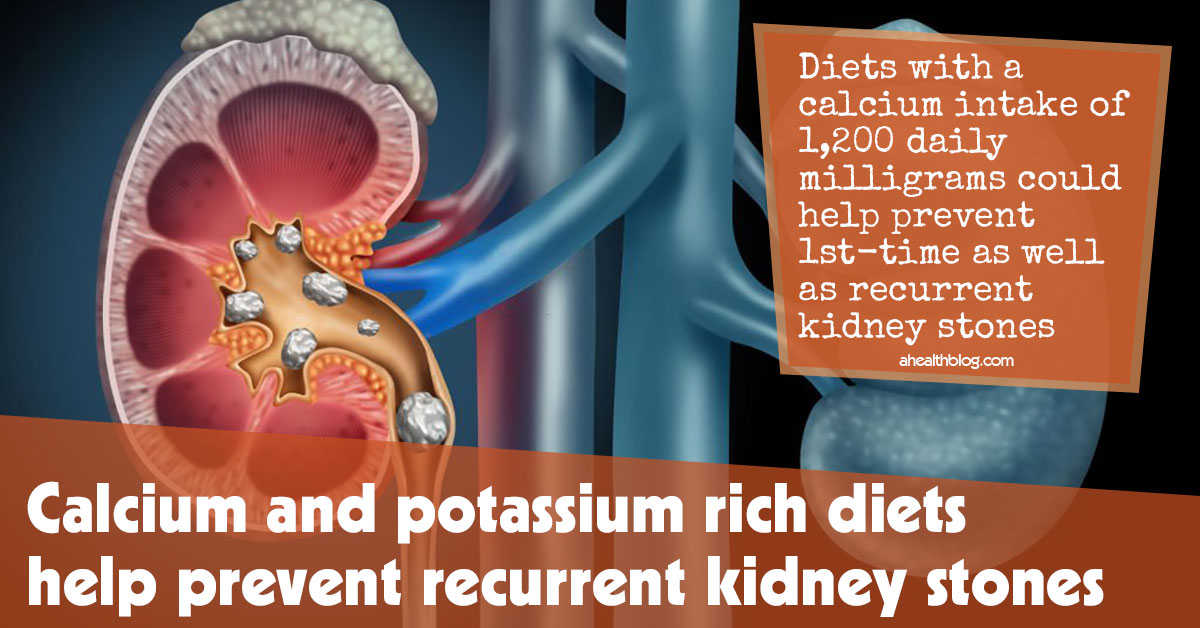 Calcium And Potassium Rich Diets Help Prevent Recurrent Kidney Stones Cta