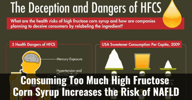 Consuming Too Much High Fructose Corn Syrup Increases The Risk Of Nafld