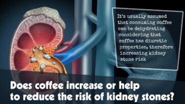 Does Coffee Increase Or Help To Reduce The Risk Of Kidney Stones F