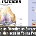 Exercise As Effective As Surgery For A Torn Meniscus In Young People
