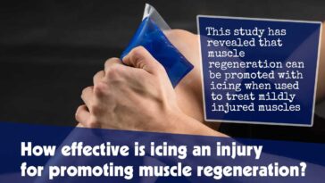 How Effective Is Icing An Injury For Promoting Muscle Regeneration F