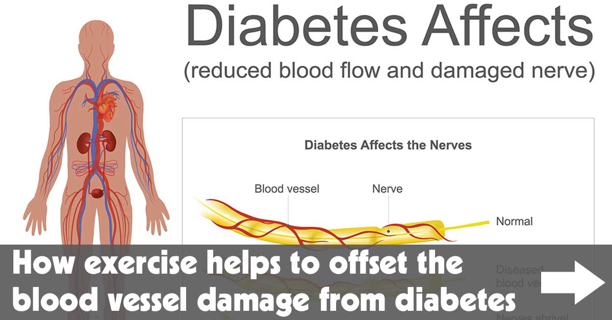 How Exercise Helps to Offset the Blood Vessel Damage From Diabetes