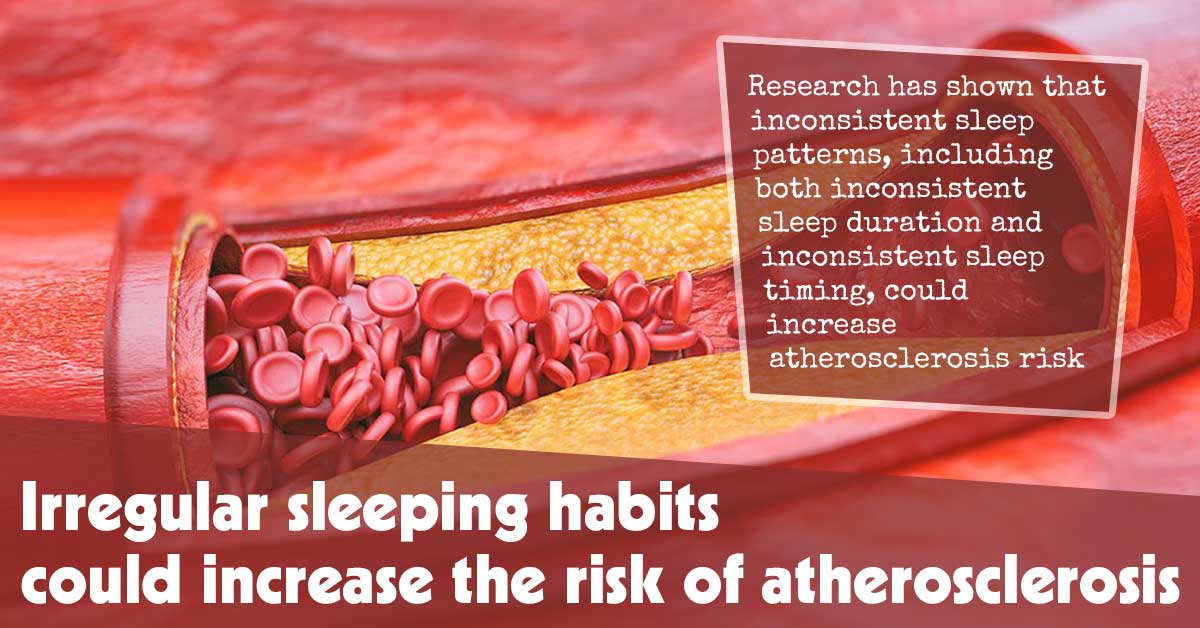 Irregular Sleeping Habits Could Increase The Risk Of Atherosclerosis