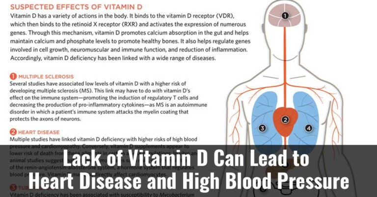 Lack Of Vitamin D Can Lead To Heart Disease And High Blood Pressure