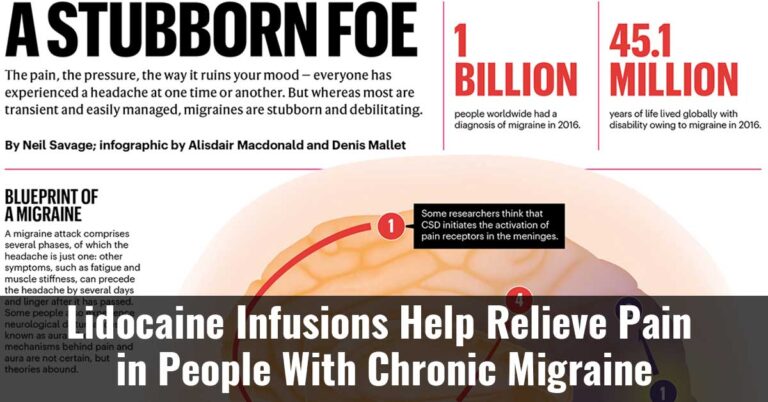 Lidocaine Infusions Help Relieve Pain In People With Chronic Migraine
