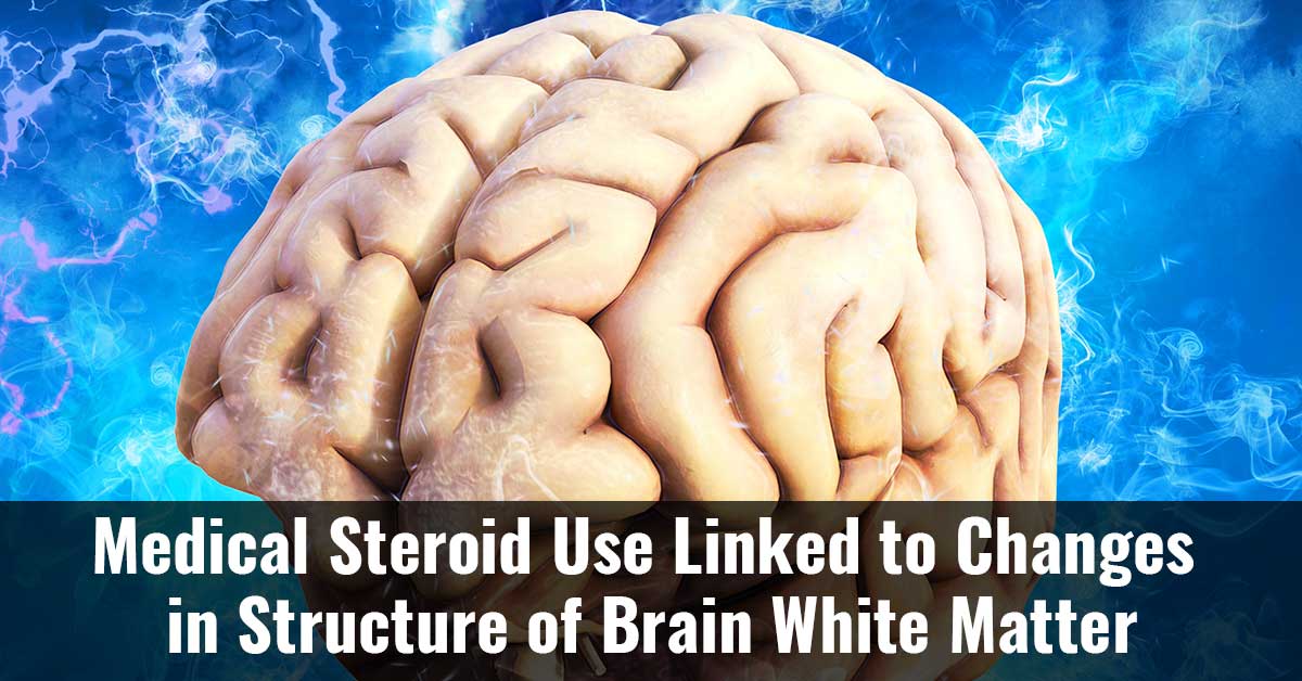 Medical Steroid Use Linked To Changes In Structure Of Brain White Matter F2