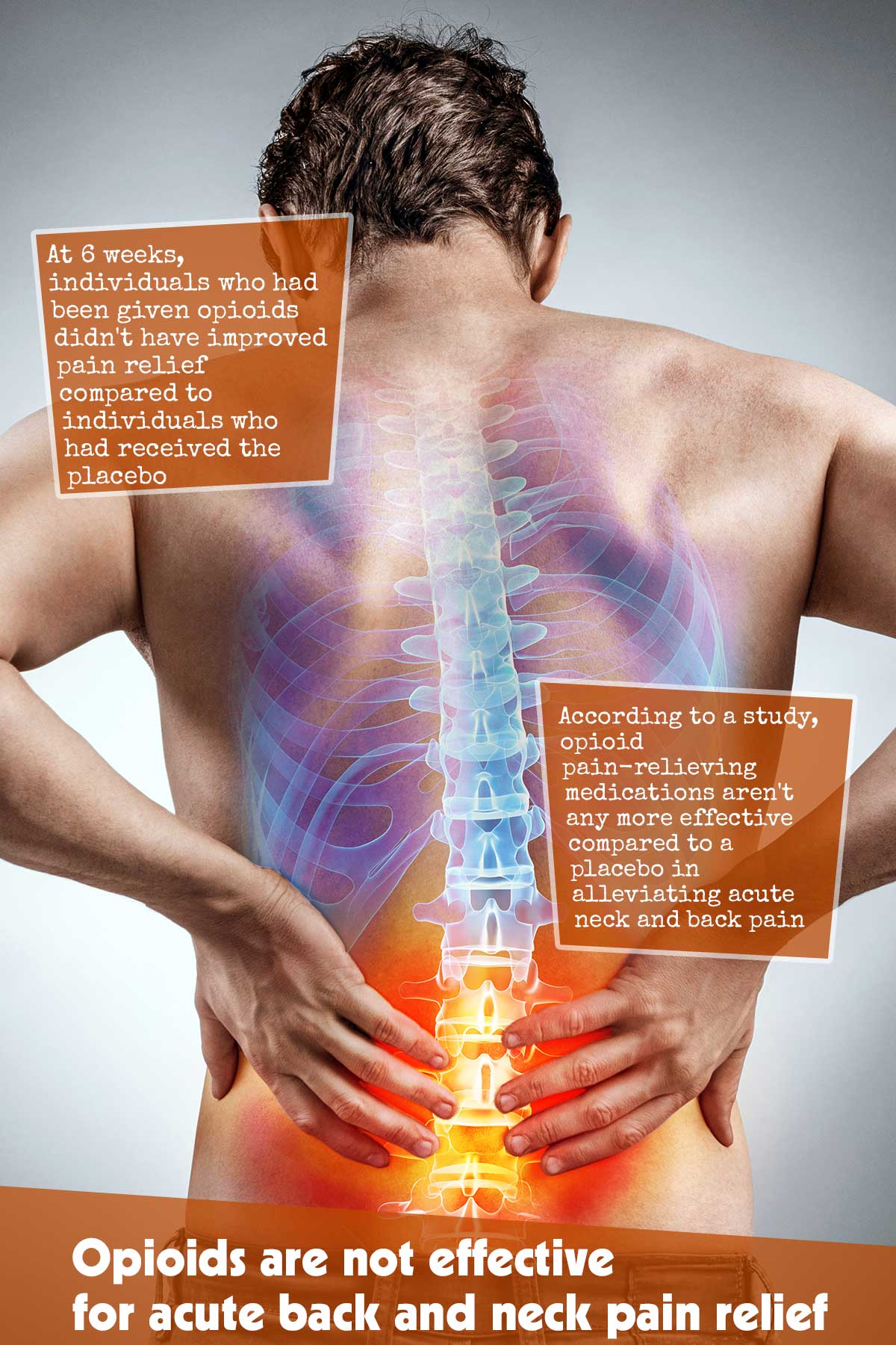 Opioids Are Not Effective For Acute Back And Neck Pain Relief