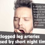 Risk Of Clogged Leg Arteries Is Increased By Short Night Time Sleep