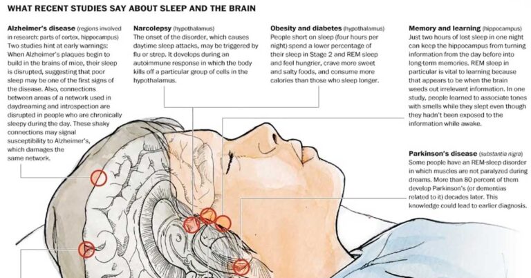 Sleep And The Brain Infographic F