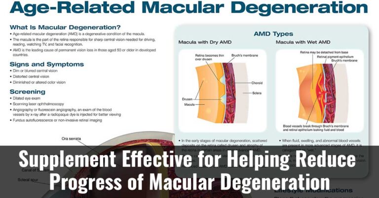 Supplement Effective For Helping Reduce Progress Of Macular Degeneration