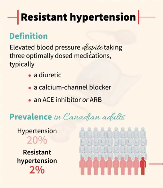 Transcranial Stimulation Helps Reduce Blood Pressure In Resistant Hypertension F2