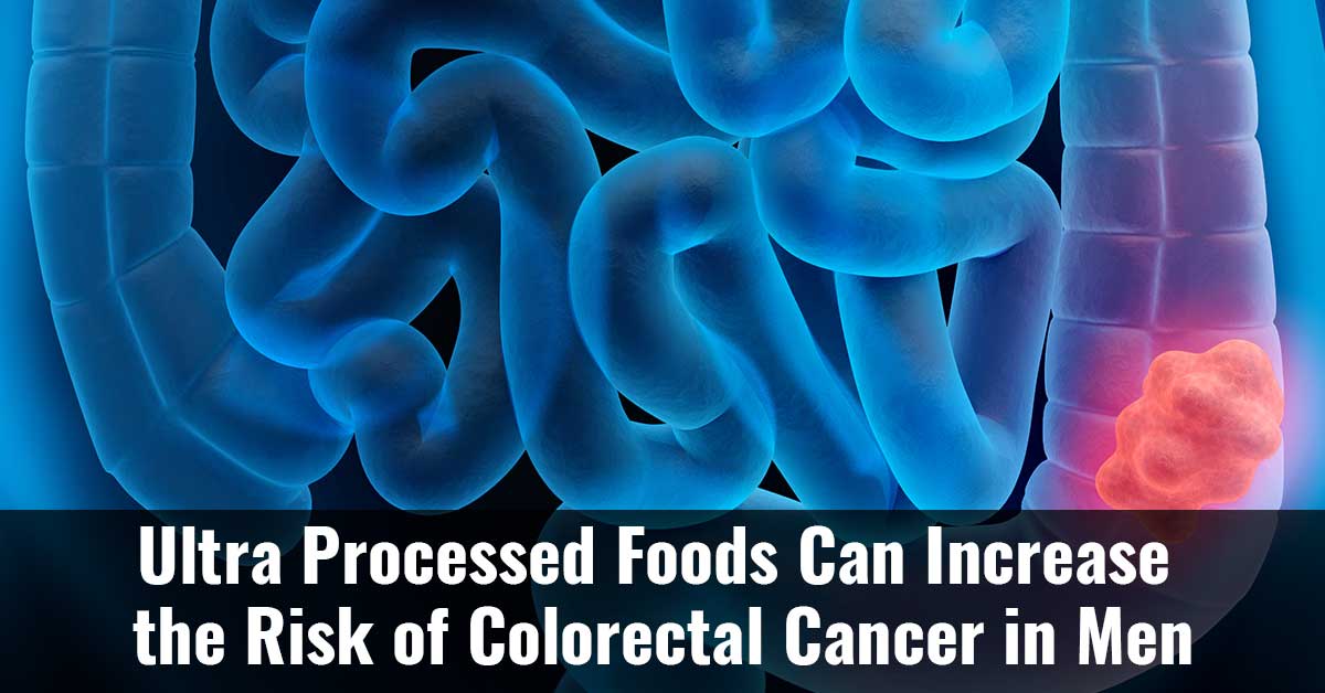 Ultra Processed Foods Can Increase The Risk Of Colorectal Cancer In Men F