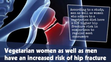 Vegetarian Women As Well As Men Have An Increased Risk Of Hip Fracture F