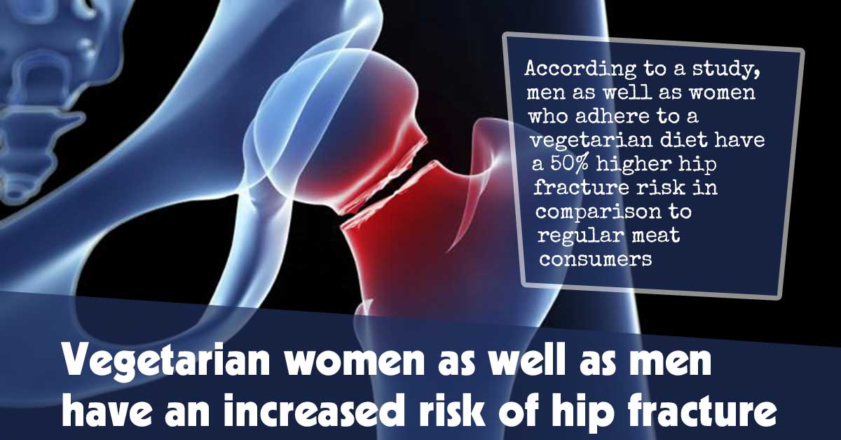 Vegetarian Women as Well as Men Have an Increased Risk of Hip Fracture