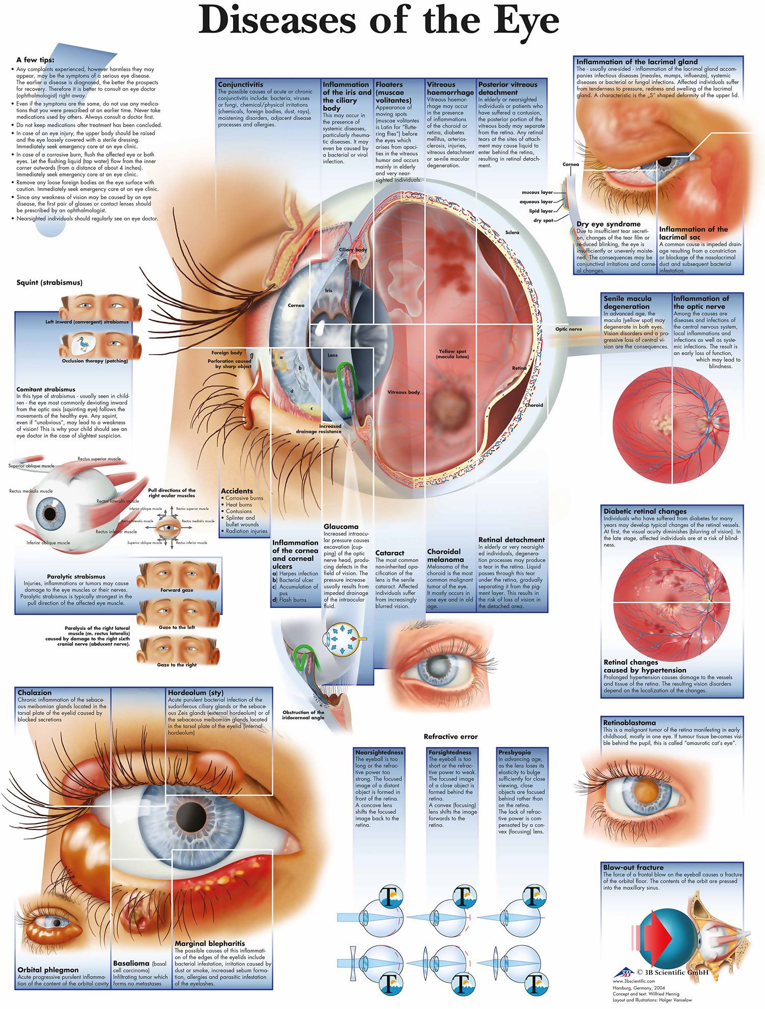 Diseases Of The Eye Chart