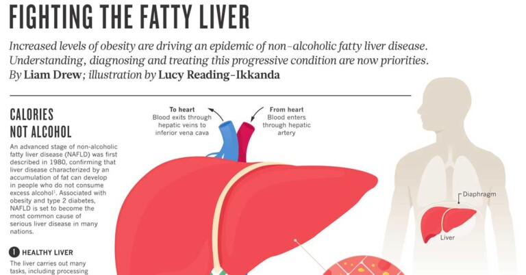 Fighting The Fatty Liver Infographic F