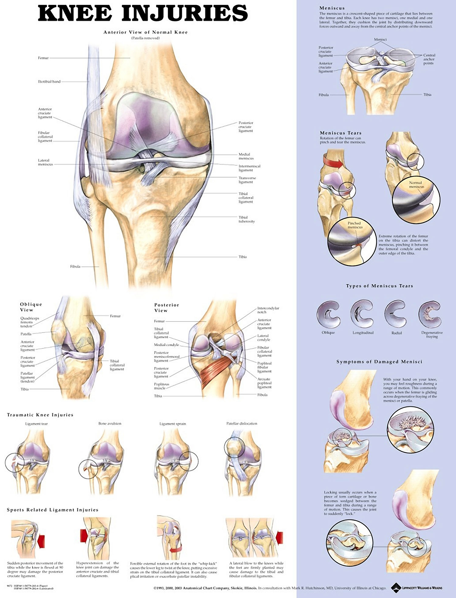 Knee Injuries Chart