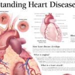 Understanding Heart Disease Anatomical Chart F