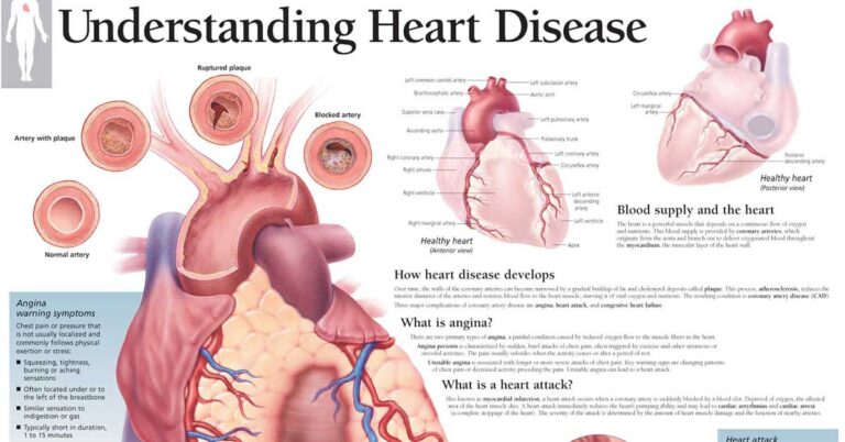 Understanding Heart Disease Anatomical Chart F